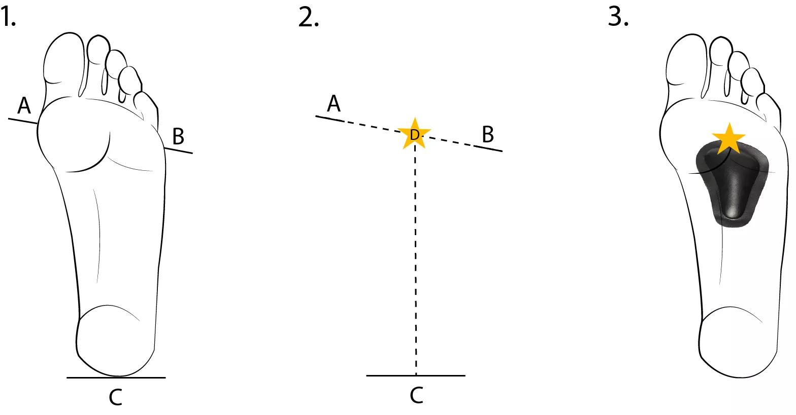 Vorfußpolster Vorfußpolster